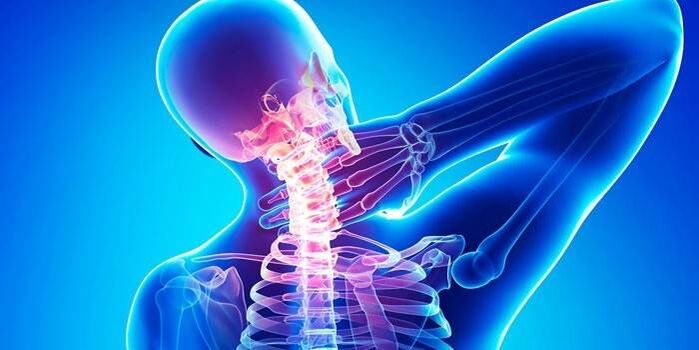Dolor en el cuello