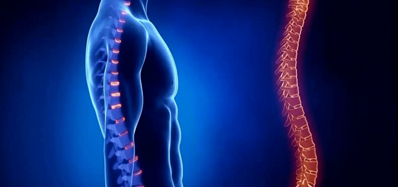 Lesiones espinales debido a la osteocondrosis.