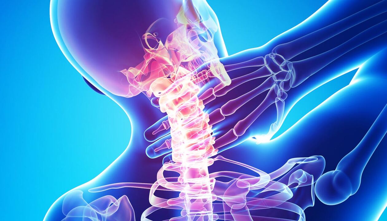 dolor de cuello debido a la osteocondrosis